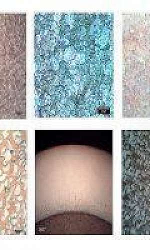 Análise metalográfica SP Análise metalográfica SP