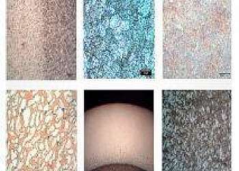 Análise metalográfica de aço carbono Análise metalográfica de aço carbono